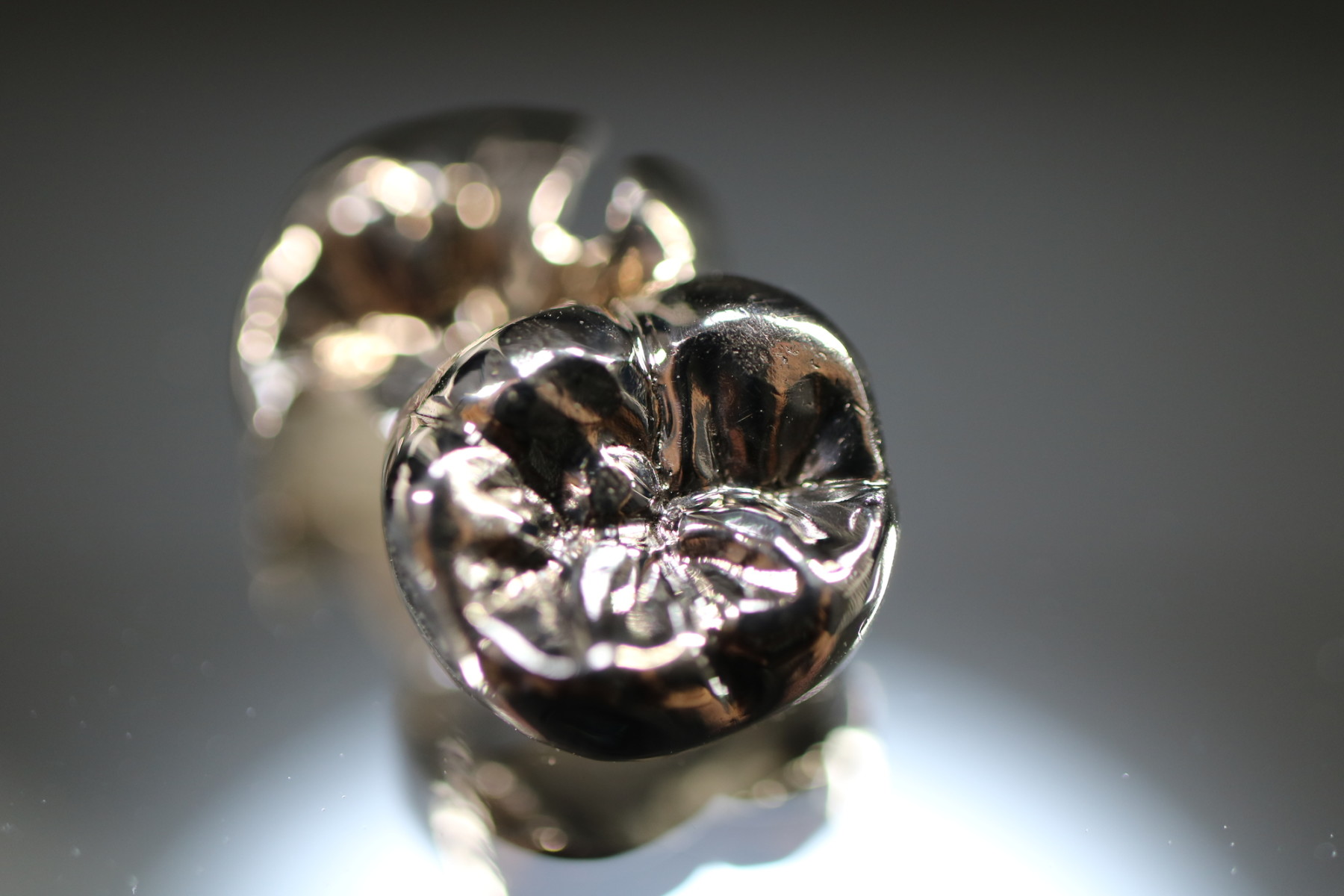 中台歯科医院　歯周病治療　FMC