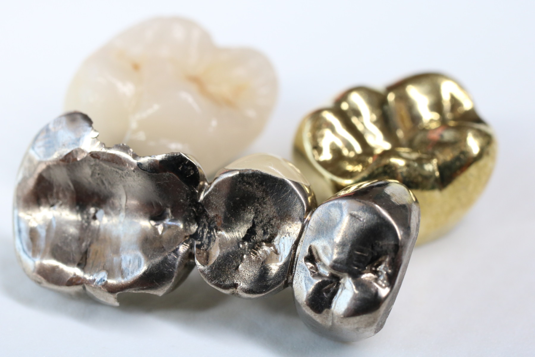 中台歯科医院　入れ歯・ブリッジ・インプラント　金銀パラジウム合金